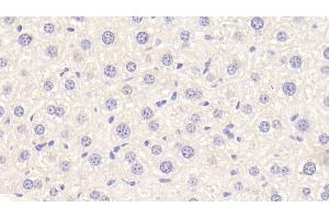 Detection of APOF in Mouse Liver Tissue using Polyclonal Antibody to Apolipoprotein F (APOF)