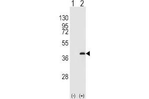 Western Blotting (WB) image for anti-Protein Phosphatase 1, Catalytic Subunit, beta Isoform (PPP1CB) antibody (ABIN3003759) (PPP1CB anticorps)
