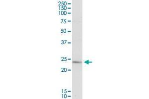 PLA2G16 MaxPab rabbit polyclonal antibody. (PLA2G16 anticorps  (AA 1-162))