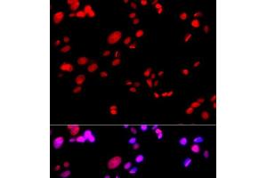 Immunofluorescence analysis of GFP-RNF168 transgenic U2OS cells using RPA2 Polyclonal Antibody (RPA2 anticorps)