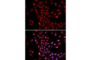 Immunofluorescence analysis of U2OS cells using KPNA4 antibody. (KPNA4 anticorps)