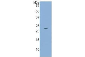 WB of Protein Standard: different control antibodies against Highly purified E. (Calreticulin Kit ELISA)