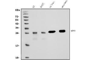 Western blot analysis of PGP9.