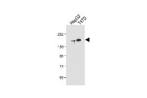 All lanes : Anti-HDAC6 Antibody (C-term) at 1:2000 dilution Lane 1: HepG2 whole cell lysate Lane 2: T47D whole cell lysate Lysates/proteins at 20 μg per lane.