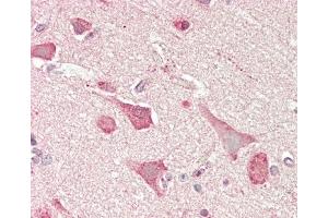 Formalin-fixed and paraffin-embedded H.