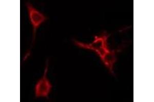 ABIN6274980 staining Hela cells by IF/ICC. (CDC42EP3 anticorps  (Internal Region))