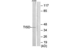 Western blot analysis of extracts from A549 cells, using TISD Antibody. (TISD anticorps  (AA 207-256))