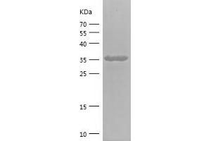 Western Blotting (WB) image for Carnitine O-Acetyltransferase (CRAT) (AA 23-113) protein (His-IF2DI Tag) (ABIN7122153)