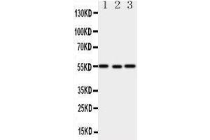 Western Blotting (WB) image for anti-X-Linked Inhibitor of Apoptosis (XIAP) (AA 14-34), (N-Term) antibody (ABIN3044425) (XIAP anticorps  (N-Term))