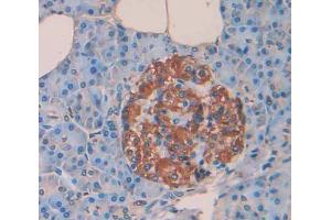 Used in DAB staining on fromalin fixed paraffin- embedded Kidney tissue (PTPRN anticorps  (AA 35-185))