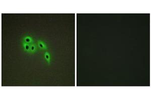 Immunofluorescence analysis of A549 cells, using DOK6 antibody. (DOK6 anticorps  (Internal Region))
