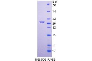 SDS-PAGE analysis of Human MUTYH Protein. (MUTYH Protéine)