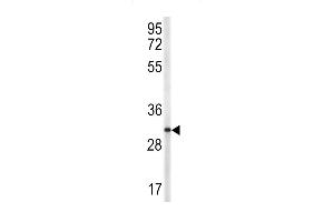 Western blot analysis of TR antibody (N-term) 6545a in NCI- cell line lysates (35 μg/lane).