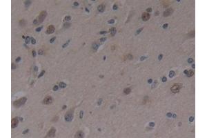 Detection of MAP3K1 in Human Brain Tissue using Polyclonal Antibody to Mitogen Activated Protein Kinase Kinase Kinase 1 (MAP3K1)