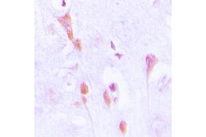 Immunohistochemical analysis of Beta-arrestin-1 (pS412) staining in human brain formalin fixed paraffin embedded tissue section. (beta Arrestin 1 anticorps  (C-Term, pSer412))