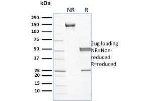 SDS-PAGE Analysis Purified Spectrin beta III Mouse Monoclonal Antibody (RG/26). (Spectrin beta Chain, Erythrocyte (SPTB) anticorps)