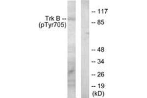 Western blot analysis of extracts from mouse kidney, using Trk B (Phospho-Tyr705) Antibody. (TRKB anticorps  (pTyr706))