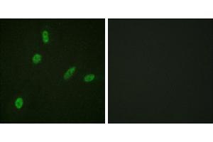 Peptide - +Immunofluorescence analysis of HeLa cells, using ETS1 (Ab-38) antibody. (ETS1 anticorps  (Thr38))