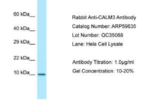 Western Blotting (WB) image for anti-Calmodulin 3 (Phosphorylase Kinase, Delta) (CALM3) (N-Term) antibody (ABIN2774263) (Calmodulin 3 anticorps  (N-Term))