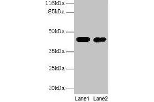 Western blot All lanes: CKB antibody at 2 μg/mL Lane 1: Mouse brain tissue Lane 2: 293T whole cell lysate Secondary Goat polyclonal to rabbit IgG at 1/10000 dilution Predicted band size: 43 kDa Observed band size: 43 kDa (CKB anticorps  (AA 2-270))