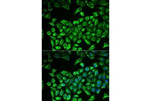 Immunofluorescence analysis of A549 cells using HAS3 antibody.