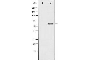 Western blot analysis of PAK1 expression in Etoposide treated 293 whole cell lysates,The lane on the left is treated with the antigen-specific peptide. (PAK1 anticorps  (Internal Region))
