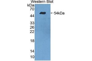 Western blot analysis of the recombinant protein. (TDP1 anticorps  (AA 4-215))