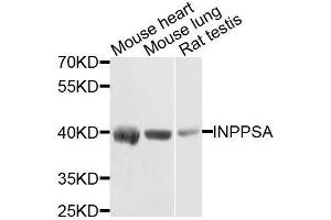 Western blot analysis of extracts of various cell lines, using INPP5A antibody. (INPP5A anticorps  (AA 10-200))