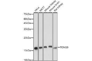 Western blot analysis of extracts of various cell lines, using TOM20 antibody (ABIN7268554) at 1:5000 dilution. (TOMM20 anticorps  (AA 20-145))