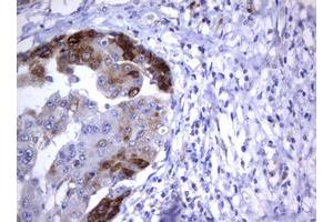 Image no. 4 for anti-Tumor Necrosis Factor Receptor Superfamily, Member 8 (TNFRSF8) (AA 19-379) antibody (ABIN1491085)