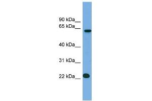 WB Suggested Anti-C21orf45 Antibody Titration:  0. (C21ORF45 anticorps  (N-Term))