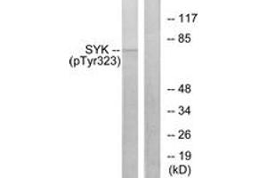 Western blot analysis of extracts from HT29 cells, using SYK (Phospho-Tyr323) Antibody. (SYK anticorps  (pTyr323))