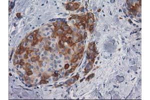 Immunohistochemistry (IHC) image for anti-Adenylate Kinase 5 (AK5) antibody (ABIN1496536) (Adenylate Kinase 5 anticorps)