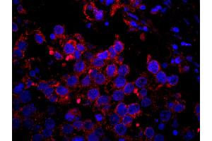 Immunofluorescence (IF) image for anti-Insulin Receptor Substrate 2 (IRS2) (AA 1288-1338) antibody (ABIN7448980) (IRS2 anticorps  (AA 1288-1338))