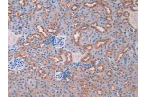 DAB staining on IHC-P; Samples: Mouse Kidney Tissue. (Resistin anticorps  (AA 21-114))