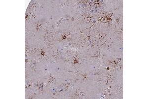 Immunohistochemical staining of human lateral ventricle with CYB561D2 polyclonal antibody  shows strong cytoplasmic positivity in fraction of glial cells. (CYB561D2 anticorps)