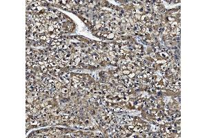IHC analysis of Liver Carboxylesterase 1/CES1 using anti-Liver Carboxylesterase 1/CES1 antibody (ABIN7602719). (CES1 anticorps  (AA 99-206))