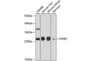 Western blot analysis of extracts of various cell lines using ETHE1 Polyclonal Antibody at dilution of 1:1000. (ETHE1 anticorps)