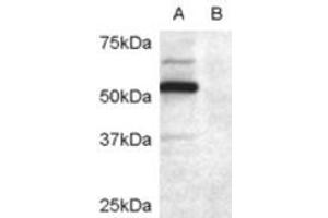 Western Blotting (WB) image for anti-Doublecortin Domain Containing 2 (DCDC2) (Internal Region) antibody (ABIN2465587) (DCDC2 anticorps  (Internal Region))