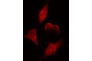 ABIN6275110 staining  HeLa cells by IF/ICC. (NEIL1 anticorps  (Internal Region))