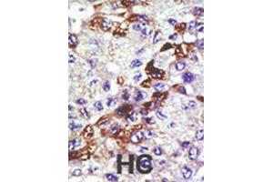 Immunohistochemistry (IHC) image for anti-Ubiquitin-Conjugating Enzyme E2E 3 (UBE2E3) antibody (ABIN3001488) (UBE2E3 anticorps)