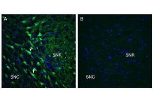 Expression of GPR55 in rat substantia nigra.