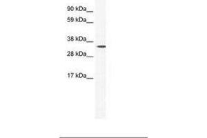 Image no. 1 for anti-Homeobox B1 (HOXB1) (AA 26-75) antibody (ABIN202186)