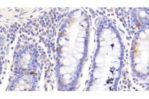 Detection of GHRL in Human Colon Tissue using Polyclonal Antibody to Ghrelin (GHRL)