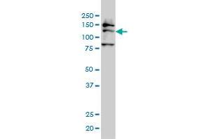 FMNL2 monoclonal antibody (M01), clone 2B4 Western Blot analysis of FMNL2 expression in IMR-32 . (FMNL2 anticorps  (AA 1-178))