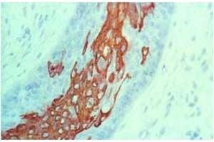 Image no. 1 for anti-Keratin 10 (KRT10) antibody (ABIN335328)
