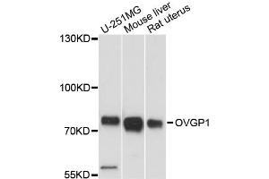 Western blot analysis of extracts of various cell lines, using OVGP1 antibody (ABIN6291552) at 1:3000 dilution. (OVGP1 anticorps)