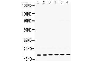 Western Blotting (WB) image for anti-Protein tyrosine Phosphatase Type IVA, Member 2 (PTP4A2) (AA 40-69), (N-Term) antibody (ABIN3043911)