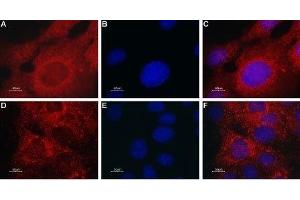 Expression of TRPML2 in mouse muscle myoblast (C2C12) cell line - Immunocytochemical staining of TRPML2 in C2C12 cells.