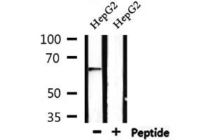 Western blot analysis of extracts from HepG2, using AIFM1 Antibody. (AIF anticorps  (C-Term))
